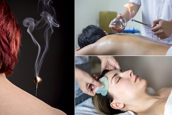 Cupping-Gua Sha-Moxibustion-large